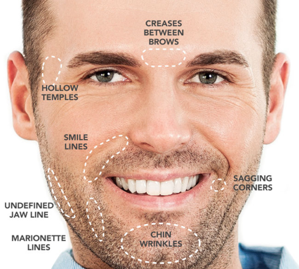 dermal fillers for men at eterna wellness medical spa in vancouver