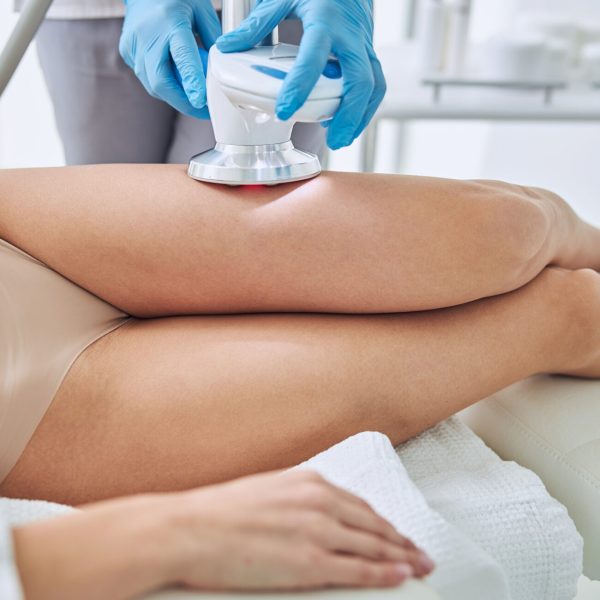 Non-surgical body treatment using BTL Exion device for skin tightening and contouring on a client's leg.