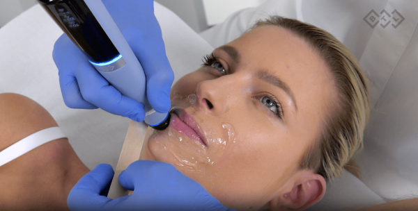 btl exion face treatment at eterna wellness medical spa in vancouver