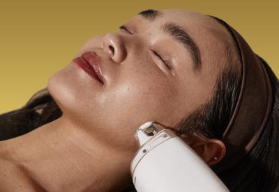 clarity 2 laser treatment for sun damage skin at eterna wellness in vancouver